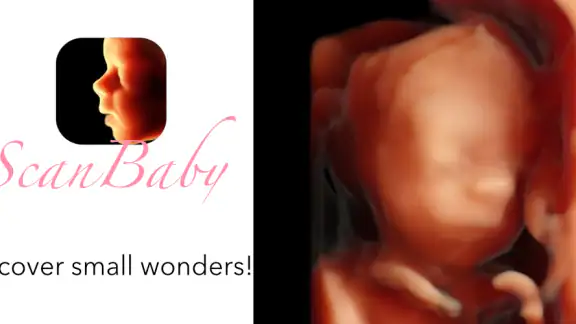 ScanBaby learn baby ultrasound screenshot