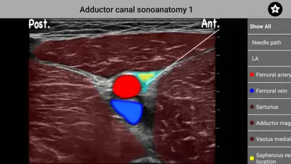 AnSo Anaesthesia Sonoanatomy screenshot