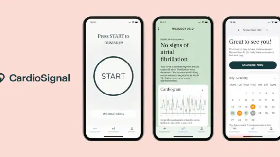 CardioSignal screenshot
