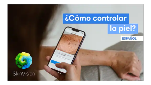 SkinVision screenshot