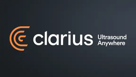 Clarius Ultrasound App screenshot