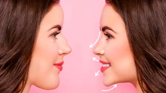 Nose Editor: Rhinoplasty App screenshot