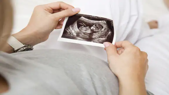 Ultrasound Week by Week screenshot