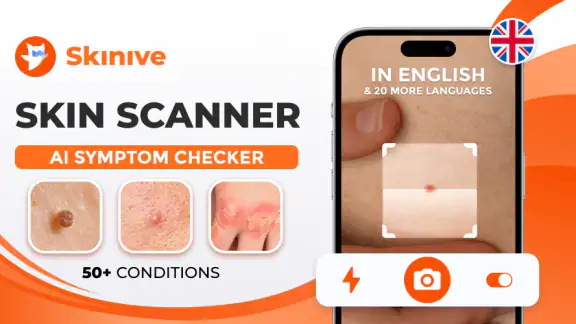 Máy quét da liễu AI Skinive screenshot