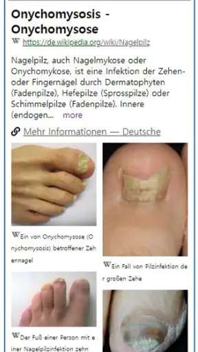 Model Dermatol – Hautkrankheit screenshot