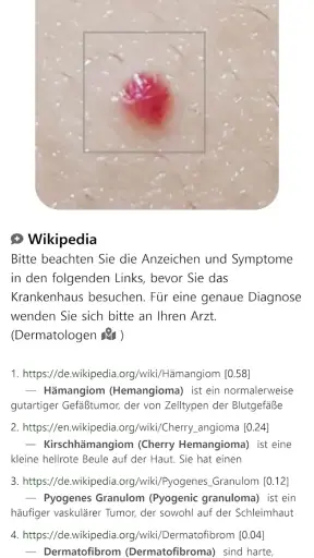 Model Dermatol – Hautkrankheit screenshot