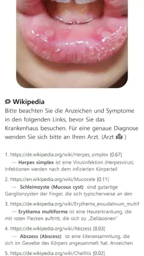 Model Dermatol – Hautkrankheit screenshot