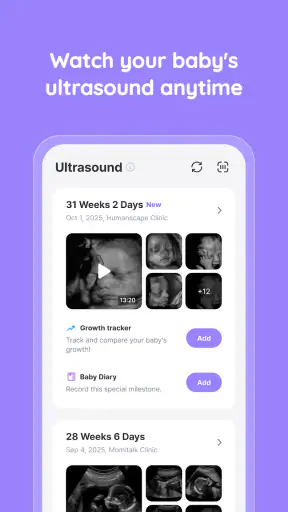 Momitalk: Pregnancy Ultrasound screenshot