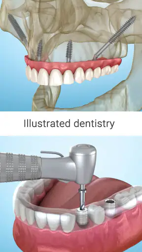 Ilustraciones dentales screenshot