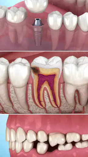 Ilustraciones dentales screenshot
