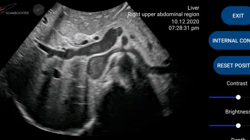 Scanbooster Ultrasound Sim screenshot