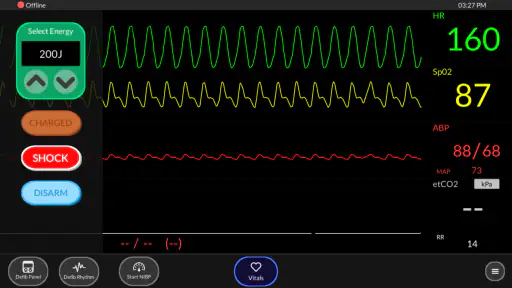 Simpl Patient Monitor screenshot