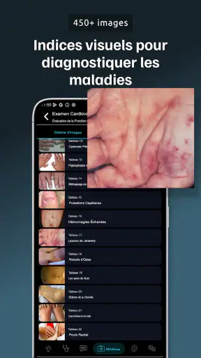 Guide OSCE Médecine screenshot