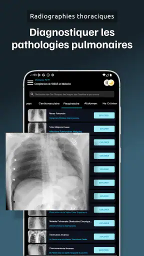 Guide OSCE Médecine screenshot