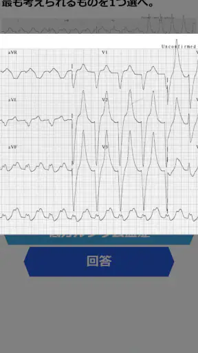 みんなde心電図 screenshot