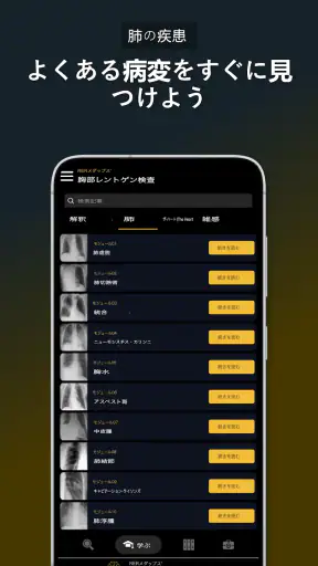 胸部X線 | 学ぶ胸X screenshot
