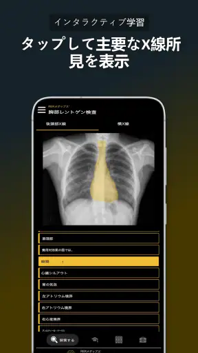 胸部X線 | 学ぶ胸X screenshot