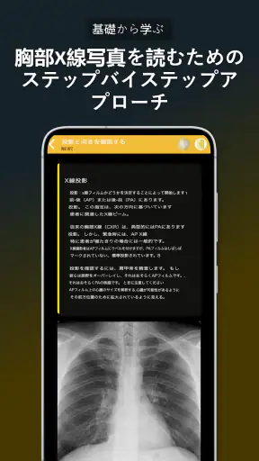 胸部X線 | 学ぶ胸X screenshot