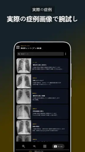胸部X線 | 学ぶ胸X screenshot