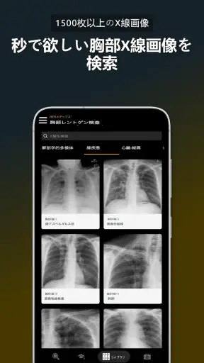 胸部X線 | 学ぶ胸X screenshot