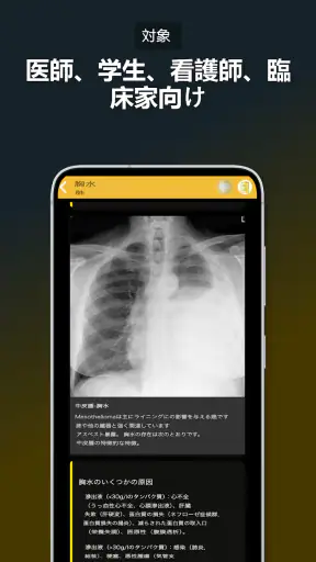 胸部X線 | 学ぶ胸X screenshot