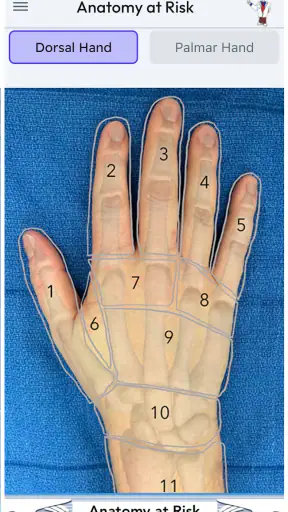 Anatomy at Risk screenshot