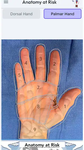 Anatomy at Risk screenshot