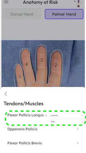 Anatomy at Risk screenshot