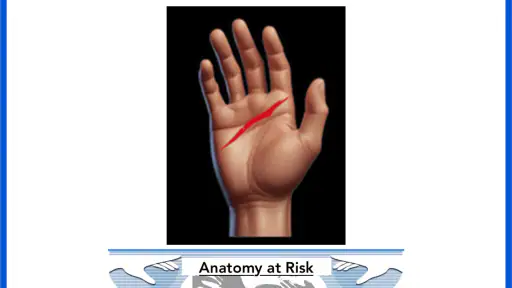 Anatomy at Risk screenshot