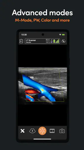 Clarius Ultrasound App screenshot