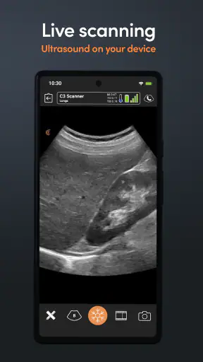 Clarius Ultrasound App screenshot
