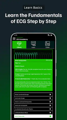ECG Academy | ECG Made Easy screenshot