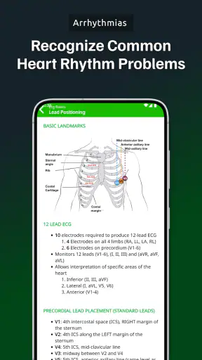 ECG Academy | ECG Made Easy screenshot