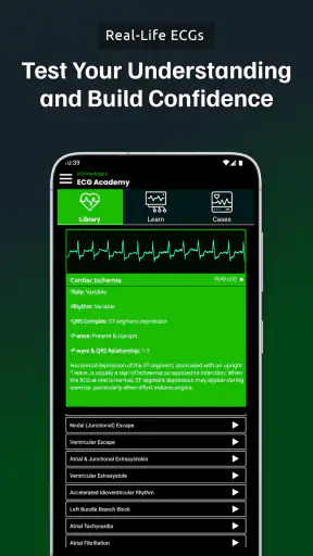 ECG Academy | ECG Made Easy screenshot