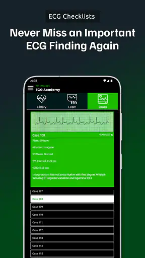 ECG Academy | ECG Made Easy screenshot