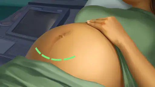 Operate Now Hospital - Surgery screenshot