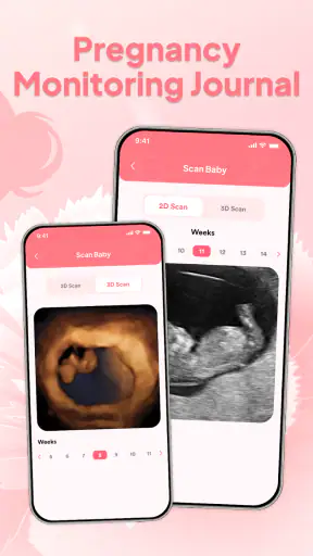 Pregnant & Baby Health Tracker screenshot