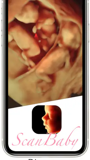 ScanBaby learn baby ultrasound screenshot
