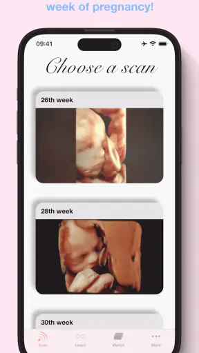 ScanBaby learn baby ultrasound screenshot
