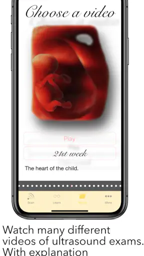 ScanBaby learn baby ultrasound screenshot