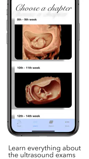 ScanBaby learn baby ultrasound screenshot