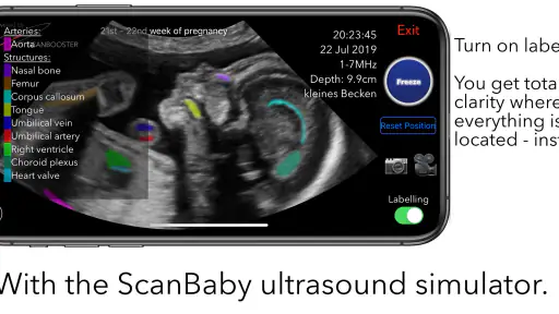 ScanBaby learn baby ultrasound screenshot