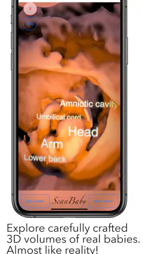 ScanBaby learn baby ultrasound screenshot