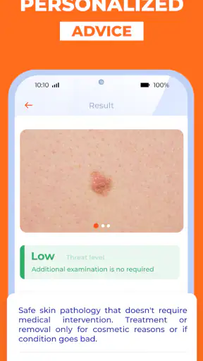 Máy quét da liễu AI Skinive screenshot